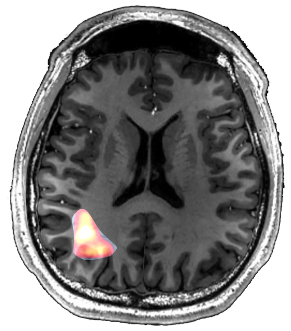 Brain scan diagram